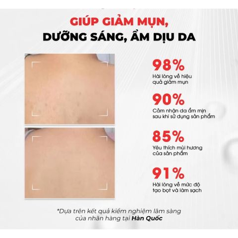 Sữa Tắm Giảm Mụn Angel's Liquid Glutathione + BHA Exfoliating Body Wash 500ml – Làm Sạch Da 388733