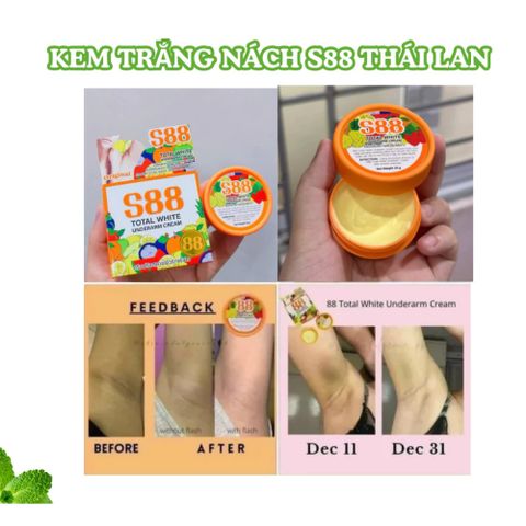 Kem Giảm Thâm Nách S88 Total White Fata Co’s – Làm Sáng Da, Khử Mùi & Giữ Nách Khô Thoáng 35g 388799