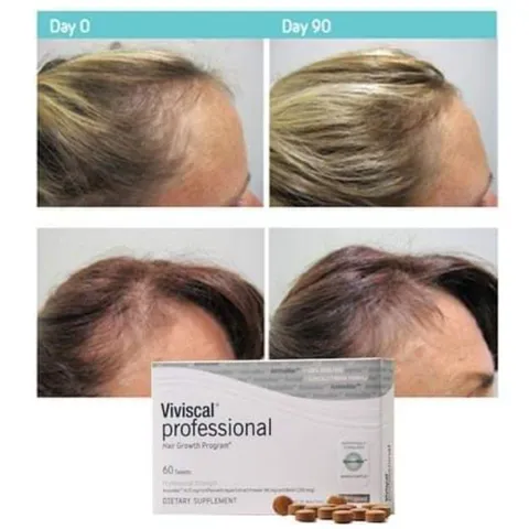 [Hàng Mỹ] Dầu gội/Dầu xả/Dầu dưỡng mọc tóc, làm dày tóc VIVISCAL Gorgeous Growth 250ml 389367