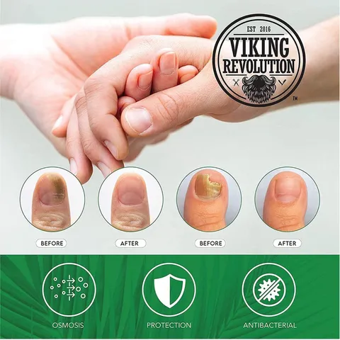 [Hàng nội địa Mỹ] Serum bôi nấm móng tay, chân dạng bút của Mỹ 389404
