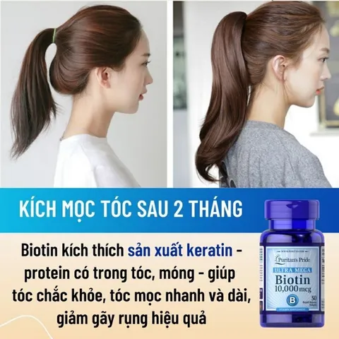 Viên uống Biotin Puritan's Pride 10000 mcg - Giảm rụng tóc, kích mọc tóc nhanh và đẹp, chăm sóc tóc khỏe mạnh