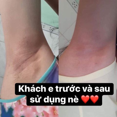 Kem Giảm Thâm Nách CÔ BƠ 8g - Chuyên Dụng Khử Mùi, Dưỡng Sáng Da Vùng Nách,  Cho Da Nhạy Cảm, Sản Phẩm Việt Nam