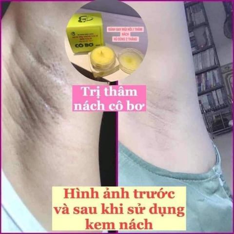 Combo 3 Hộp Kem Khử Thâm Nách & Hôi Nách Cô Bơ - Sáng Mịn Da 8gr - Giảm Thâm, Ngăn Mùi Hiệu Quả cho Tất Cả Đối Tượng