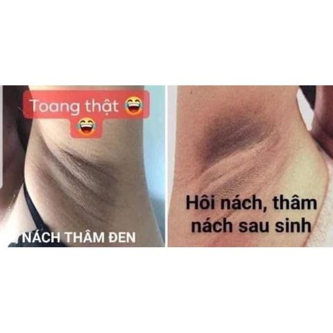 Combo 3 Hộp Kem Khử Thâm Nách & Hôi Nách Cô Bơ - Sáng Mịn Da 8gr - Giảm Thâm, Ngăn Mùi Hiệu Quả cho Tất Cả Đối Tượng