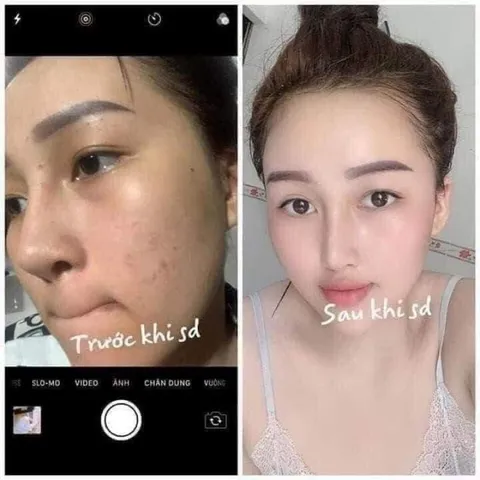 Kem Face Nhật MEIDUZI Chính Hãng - Dưỡng Trắng Hồng, Chống Nắng, Tri Mụn, Se Khít Lỗ Chân Lông, Phục Hồi Da Mịn Màng