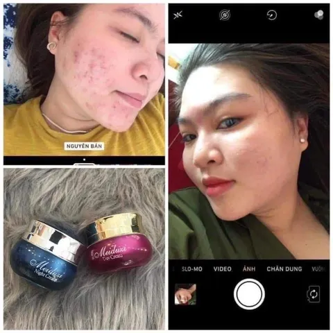 Kem Face Nhật MEIDUZI Chính Hãng - Dưỡng Trắng Hồng, Chống Nắng, Tri Mụn, Se Khít Lỗ Chân Lông, Phục Hồi Da Mịn Màng