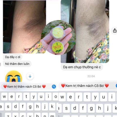 Combo 100 Kem Cô Bơ Khử Mùi & Xóa Thâm Nách 8gr - Thảo Dược An Toàn, Hiệu Quả Sau 3 Ngày Sử Dụng