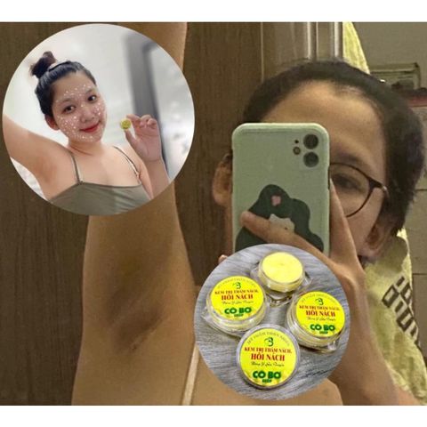 Combo 100 Kem Cô Bơ Khử Mùi & Xóa Thâm Nách 8gr - Thảo Dược An Toàn, Hiệu Quả Sau 3 Ngày Sử Dụng