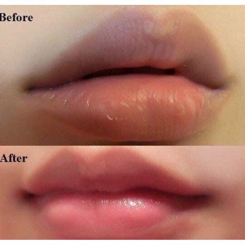 Son Dưỡng Môi Collagen Có Màu Dành Cho Bà Bầu - Giảm Thâm, Dưỡng Ẩm, Tăng Cường Màu Sau Phun Xăm, An Toàn, Thiên Nhiên, Không Chì