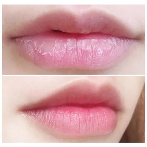 Son Dưỡng Môi Collagen Có Màu Dành Cho Bà Bầu - Giảm Thâm, Dưỡng Ẩm, Tăng Cường Màu Sau Phun Xăm, An Toàn, Thiên Nhiên, Không Chì