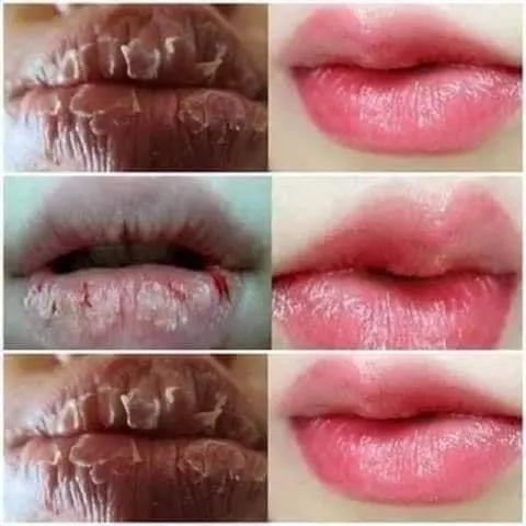 Son Dưỡng Môi Collagen Có Màu Dành Cho Bà Bầu - Giảm Thâm, Dưỡng Ẩm, Tăng Cường Màu Sau Phun Xăm, An Toàn, Thiên Nhiên, Không Chì