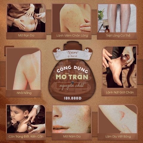 Mỡ Trăn Nguyên Chất N'Store 75gr - Sản phẩm triệt lông an toàn, mờ rạn da, và dịu vết bỏng - Chăm sóc da tự nhiên tại nhà.