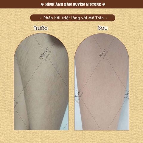 Mỡ Trăn Nguyên Chất N'Store 75gr - Sản phẩm triệt lông an toàn, mờ rạn da, và dịu vết bỏng - Chăm sóc da tự nhiên tại nhà.