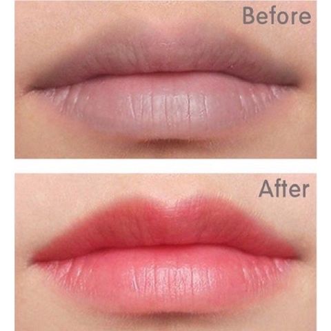 Combo Dưỡng Môi Thiên Di - Tinh Chất Cấy Màu Hồng Tự Nhiên, Tẩy Thâm, Chống Khô, Collagen Tăng Cường Độ Ẩm