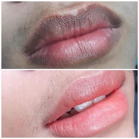 Combo Dưỡng Môi Thiên Di - Tinh Chất Cấy Màu Hồng Tự Nhiên, Tẩy Thâm, Chống Khô, Collagen Tăng Cường Độ Ẩm
