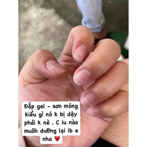 Combo 2 Hộp Dưỡng Móng Thiên Di - Dưỡng Móng Nhanh Dài, Chắc Khỏe Và Bóng Đẹp Sau Khi Làm Nail