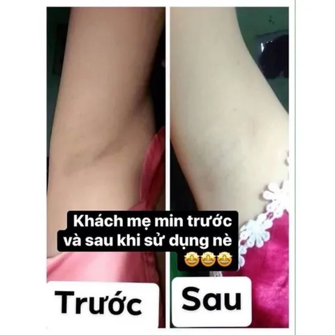 Kem Khử Mùi Hôi Nách Cô Bơ 30gr - Giảm Thâm, Ngăn Mồ Hôi, Dưỡng Trắng Da Nách - Dành Cho Mẹ Bầu và Trẻ Em Trên 10 Tuổi