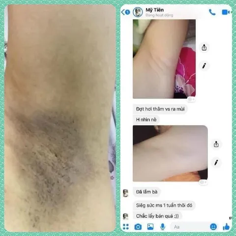 Kem Khử Mùi Hôi Nách Cô Bơ 30gr - Giảm Thâm, Ngăn Mồ Hôi, Dưỡng Trắng Da Nách - Dành Cho Mẹ Bầu và Trẻ Em Trên 10 Tuổi