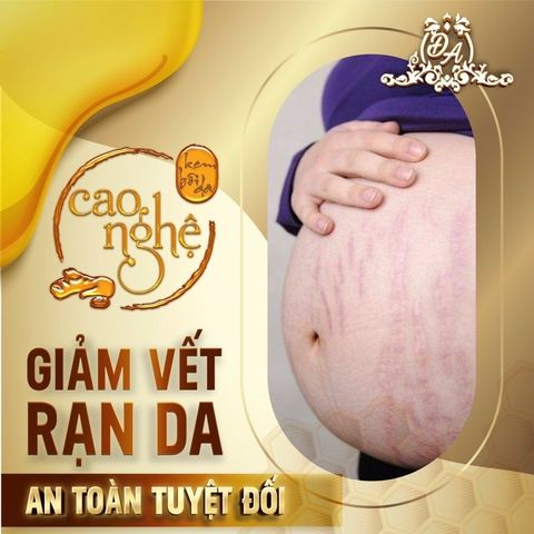 Cao Nghệ Phục Hồi Chuyên Sâu Collagen X3 - Kem Dưỡng Sáng Da, Chống Lão Hoá, Làn Da Mịn Màng, Mỹ Phẩm Đông Anh