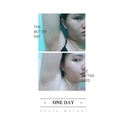Combo 5 Hộp Kem Khử Thâm Nách Cô Bơ 8gr - Đánh Bay Hôi Nách, Làm Trắng An Toàn, Thơm Mùi Sâm, An Toàn Cho Mẹ Bầu