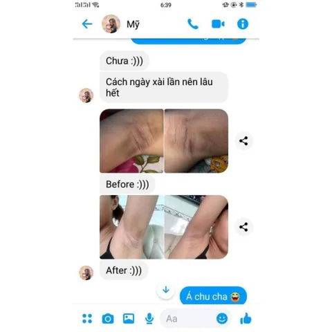 Combo 5 Hộp Kem Khử Thâm Nách Cô Bơ 8gr - Đánh Bay Hôi Nách, Làm Trắng An Toàn, Thơm Mùi Sâm, An Toàn Cho Mẹ Bầu