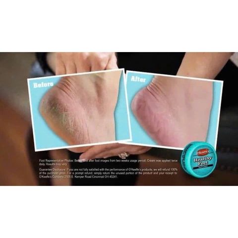 Kem Dưỡng Gót Chân O'Keeffe's Healthy Feet 85g - Giải Pháp Đặc Trị Da Khô Nứt Nẻ, Cung Cấp Độ Ẩm Lâu Dài, Chăm Sóc Bàn Chân Khỏe Mạnh
