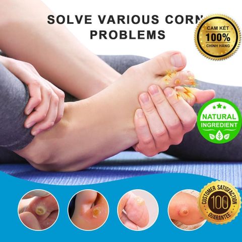 Miếng Dán Mụn Cóc Nhật Bản 42 Miếng - Wart Remover Từ Thảo Mộc, Hiệu Quả An Toàn, Giúp Loại Bỏ Mụn Cóc, Nốt Ruồi, Mụn Thịt Tại Nhà