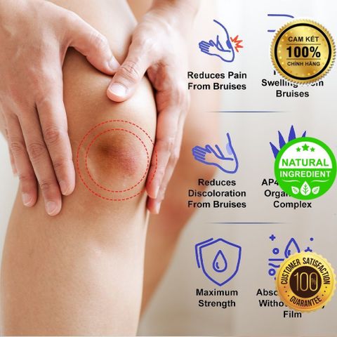 Kem Bôi Vết Bầm, Vết Thâm Dưới Da - Mega Care 100% Tự Nhiên, Giảm Sưng Tấy, Phục Hồi Da Tổn Thương Hiệu Quả