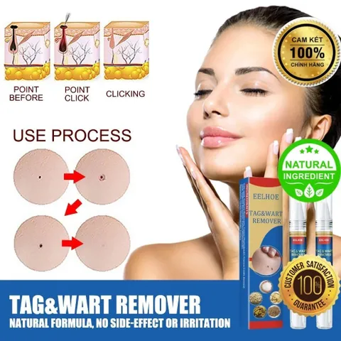 Bút Chấm Mụn Cóc và Nốt Ruồi EELHOE - Giải Pháp Tự Nhiên Loại Bỏ Mụn Thịt Thừa, Hiệu Quả Rõ Rệt Sau 2 Tuần Sử Dụng