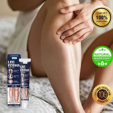 Kem Bôi Giảm Sưng Phù Nề Chân - Hỗ Trợ Thoát Dịch Từ Thiên Nhiên, Giúp Lưu Thông Khí Huyết Và Làm Dịu Cảm Giác Nặng Chân