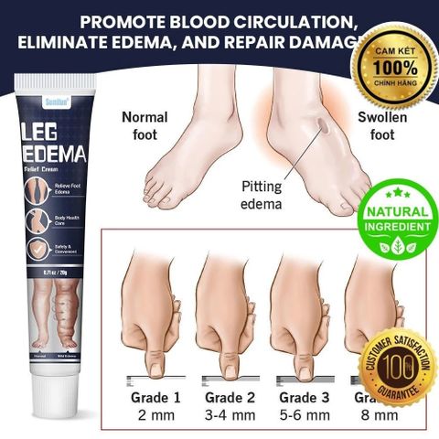 Kem Bôi Giảm Sưng Phù Nề Chân - Hỗ Trợ Thoát Dịch Từ Thiên Nhiên, Giúp Lưu Thông Khí Huyết Và Làm Dịu Cảm Giác Nặng Chân
