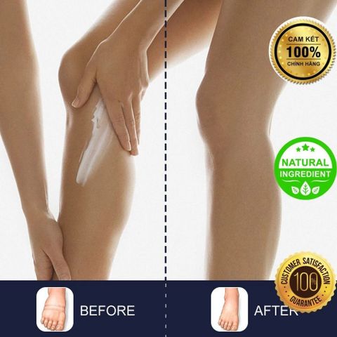 Kem Bôi Giảm Sưng Phù Nề Chân - Hỗ Trợ Thoát Dịch Từ Thiên Nhiên, Giúp Lưu Thông Khí Huyết Và Làm Dịu Cảm Giác Nặng Chân