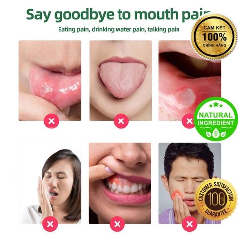 Chai Xịt Nhiệt Miệng Thảo Mộc - Giảm Đau, Ngăn Ngừa Lở Miệng và Loét Miệng - Kháng Khuẩn Tự Nhiên An Toàn cho Răng Miệng