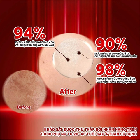 Kem Dưỡng Da Mờ Nám Tranexa Acid Angel's Liquid Mela Cream 50ml - Giúp Làm Sáng Da, Giảm Thâm Mụn, Phục Hồi Sắc Tố Da