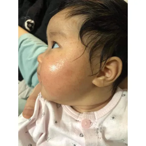 Kem Bôi Da Minh Hùng Chính Hãng - Chăm Sóc Da Bé, Tái Tạo Da, Chống Ngứa, Dành Cho Trẻ Sơ Sinh và Hỗ Trợ Điều Dị Ứng Da