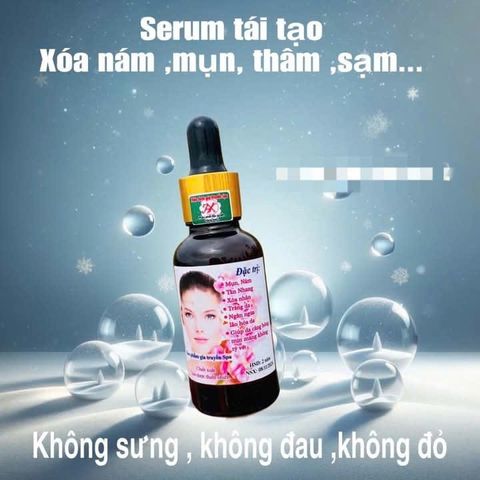 Serum Tái Tạo Da Chuyên Mụn, Nám, Tàn Nhang - Giúp Da Căng Bóng, Mịn Màng và Trắng Sáng, Sản Phẩm Chăm Sóc Da Chất Lượng Cao