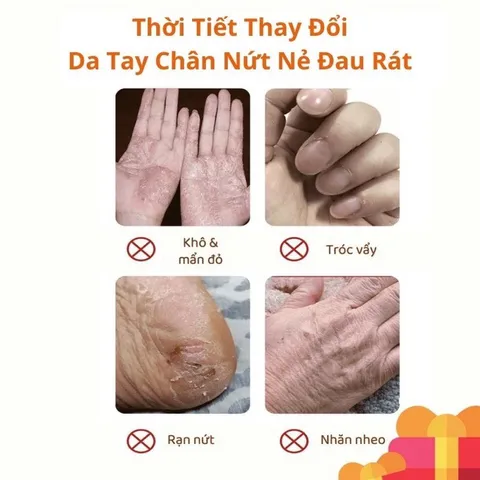 Kem Dưỡng Ẩm Chống Nẻ Da Heyxi 20g - Giúp Phục Hồi, Cấp Nước Cho Da Khô, Nứt Nẻ, Mịn Màng, Khỏe Mạnh