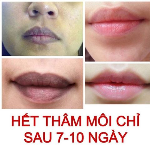 Dưỡng Môi Collagen Thiên Di - Khử Thâm, Dưỡng Hồng, Làm Mềm Mịn Môi, Chống Nắng Bảo Vệ Tia UV, Hiệu Quả Dài Lâu