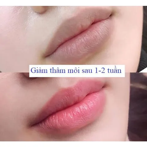 Dưỡng Môi Collagen Thiên Di - Khử Thâm, Dưỡng Hồng, Làm Mềm Mịn Môi, Chống Nắng Bảo Vệ Tia UV, Hiệu Quả Dài Lâu
