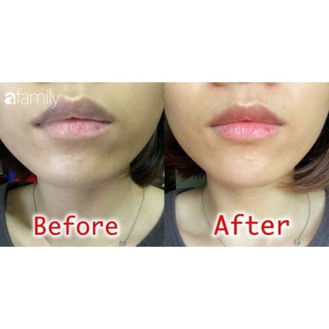 Dưỡng Môi Collagen Thiên Di - Khử Thâm, Dưỡng Hồng, Làm Mềm Mịn Môi, Chống Nắng Bảo Vệ Tia UV, Hiệu Quả Dài Lâu