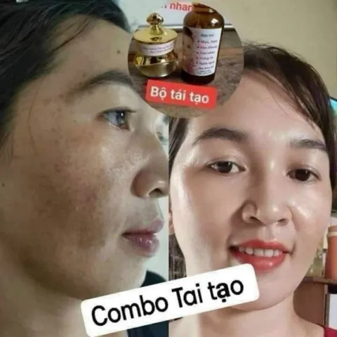 Hũ Kem Dưỡng Tái Tạo Da Gia Truyền - Giúp Da Căng Bóng, Mịn Màng, Chống Nám, Mụn, Tàn Nhang - Sản Phẩm Chăm Sóc Da Mặt Chất Lượng Cao