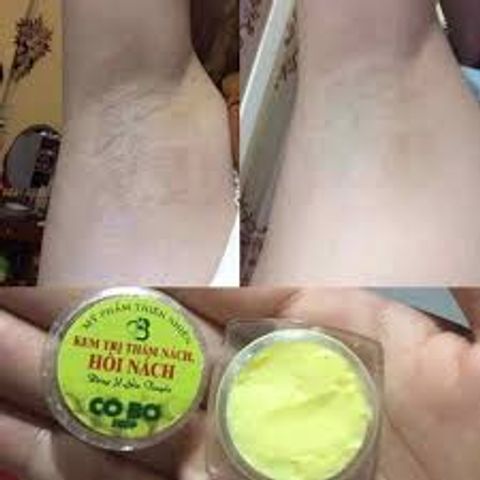 Kem Khử Hôi Nách Thâm Nách Cô Bơ Chính Hãng 30gr - Giải Pháp Tiết Kiệm Cho Da Mềm Mịn Và Thoáng Khô