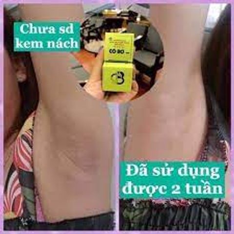 Kem Khử Hôi Nách Thâm Nách Cô Bơ Chính Hãng 30gr - Giải Pháp Tiết Kiệm Cho Da Mềm Mịn Và Thoáng Khô