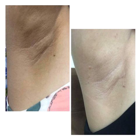 Kem Khử Hôi Nách Thâm Nách Cô Bơ Chính Hãng 30gr - Giải Pháp Tiết Kiệm Cho Da Mềm Mịn Và Thoáng Khô