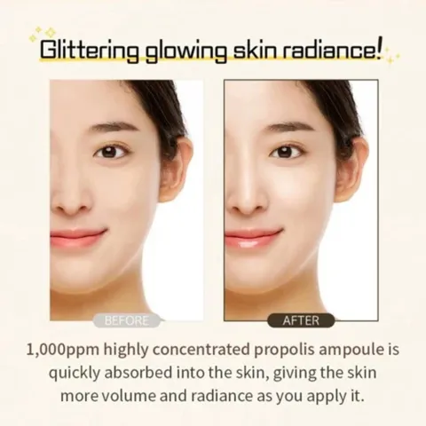 Tinh Chất Serum Keo Ong Wellderma Propolis 1000 - 50ml - Bí Quyết Cho Làn Da Sáng Khỏe, Căng Bóng
