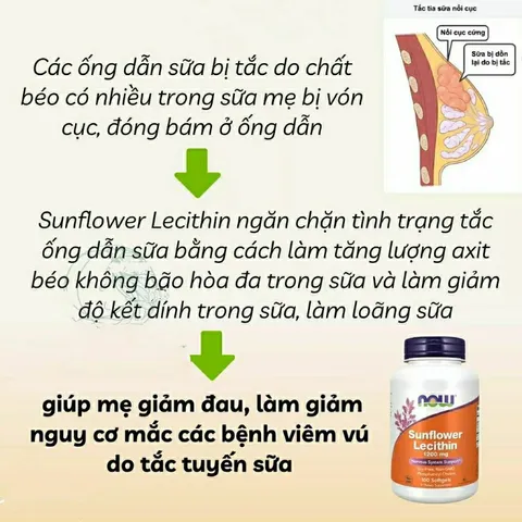 [ Date 2028] Viên uống chống tắc tia sữa Now Sunflower Lecithin 1200mg