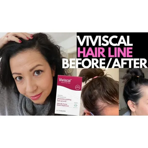 [ Date 2027] Viên mọc tóc Nam/Nữ Viviscal