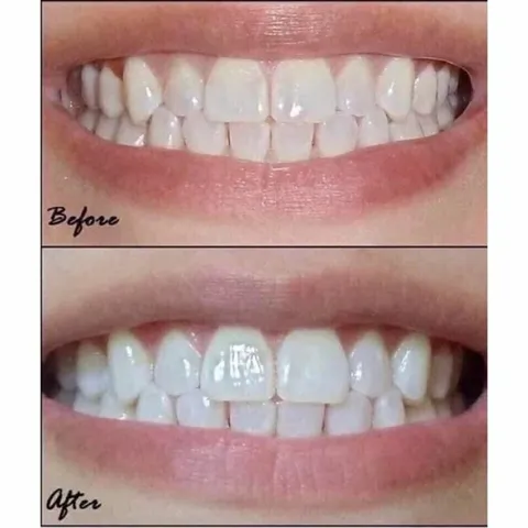 [ Date 2025] Kem đánh răng trắng răng Crest White Brilliance 99g