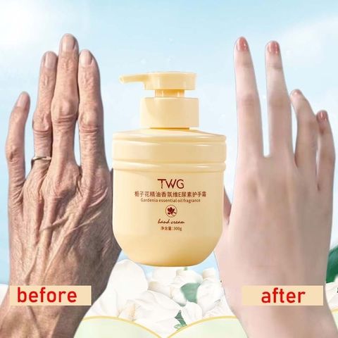 Kem Dưỡng Da Tay Gardenia Vitamin E 300g - Giúp Dưỡng Ẩm, Làm Trắng, Chống Khô Nứt Nẻ Tay Chân