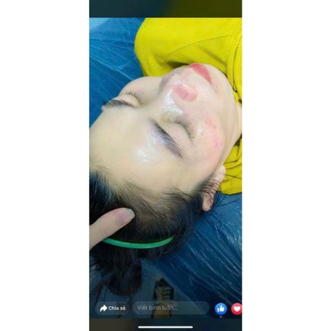 Kem Dưỡng Trắng Da MeSo Spa - Giúp Căng Bóng Da, Mờ Thâm Nám, Dưỡng Ẩm Mịn Màng, 30g